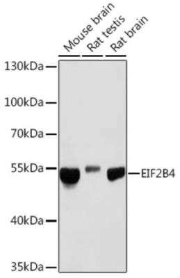 Western Blot: eIF2B4 AntibodyAzide and BSA Free [NBP2-94484]