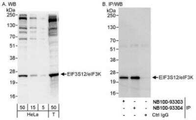 Western Blot: eIF3K Antibody [NB100-93304]