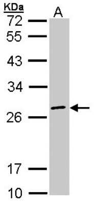 Western Blot: eIF3K Antibody [NBP1-31285]