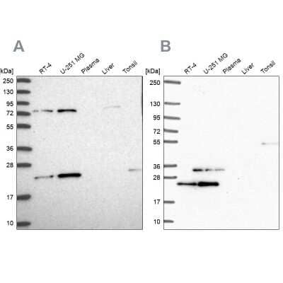 Western Blot: eIF3K Antibody [NBP1-91865]