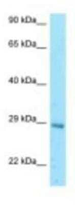 Western Blot: eIF3K Antibody [NBP1-98396]