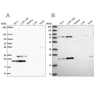 Western Blot: eIF3K Antibody [NBP2-56764]