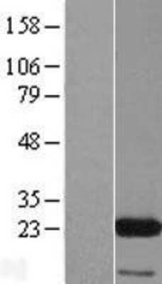 Western Blot: eIF3K Overexpression Lysate [NBP2-07433]