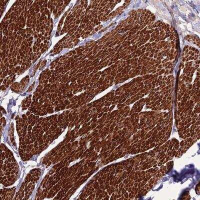 Immunohistochemistry-Paraffin: eIF3X Antibody [NBP1-91866]