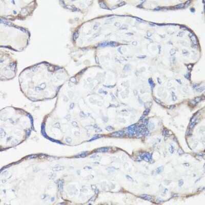 Immunohistochemistry-Paraffin: eIF3X Antibody - BSA Free [NBP3-03247]