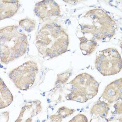 Immunohistochemistry-Paraffin: eIF3X Antibody - BSA Free [NBP3-03247]