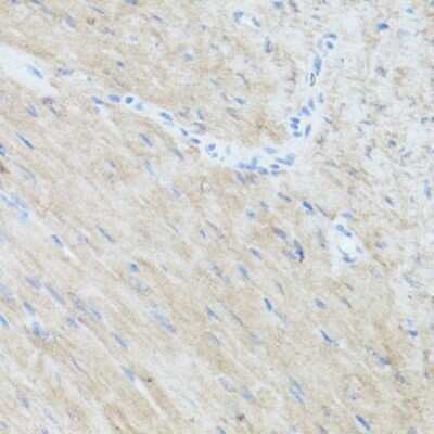 Immunohistochemistry-Paraffin: eIF3X Antibody - BSA Free [NBP3-03247]