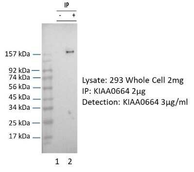 Immunoprecipitation: eIF3X Antibody [NBP2-87345]
