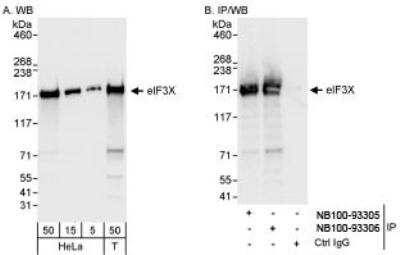 Western Blot: eIF3X Antibody [NB100-93306]