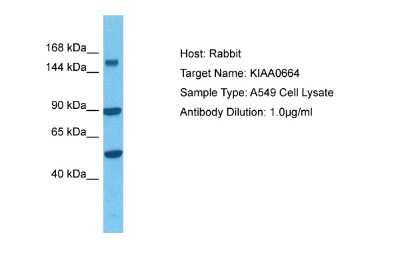 Western Blot: eIF3X Antibody [NBP2-87345]