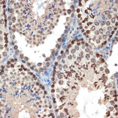 Immunohistochemistry-Paraffin: eIF3e Antibody (3H4N2) [NBP3-16184]