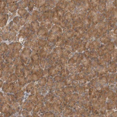 Immunohistochemistry-Paraffin: eIF3e Antibody [NBP1-84869]