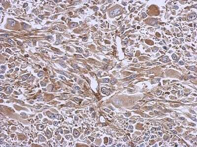 Immunohistochemistry-Paraffin: eIF3e Antibody [NBP2-16298]