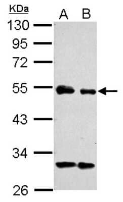 Western Blot: eIF3e Antibody [NBP2-16298]