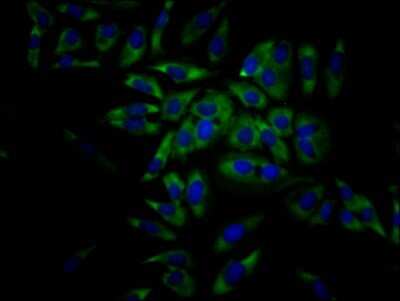 Immunocytochemistry/ Immunofluorescence: eIF4A1 Antibody (7C3) [NBP3-15220]