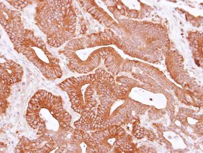 Immunohistochemistry-Paraffin: eIF4A1 Antibody [NBP2-16302]