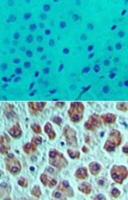 Immunohistochemistry-Paraffin: eIF4A1 Antibody [NBP2-24632]
