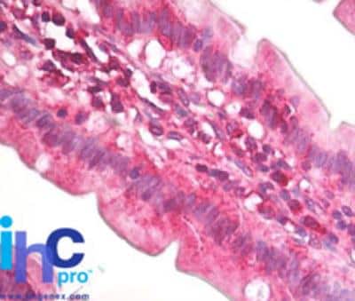 Immunohistochemistry-Paraffin: eIF4A2 Antibody [NBP2-24529]