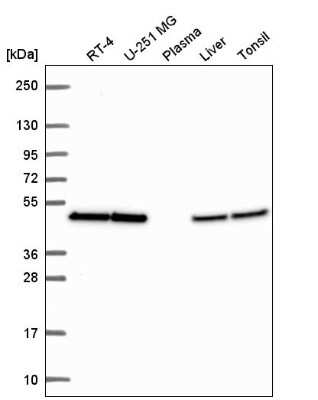 Western Blot: eIF4A2 Antibody [NBP2-57716]