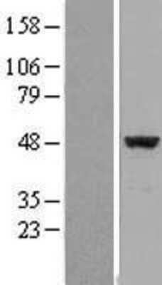 Western Blot: eIF4A2 Overexpression Lysate [NBL1-10202]