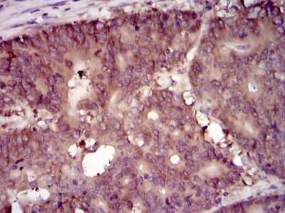 Immunohistochemistry: eIF4B Antibody (1F5) - BSA Free [NBP2-37488]