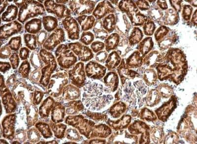 Immunohistochemistry-Paraffin: eIF4B Antibody [NBP2-16306]