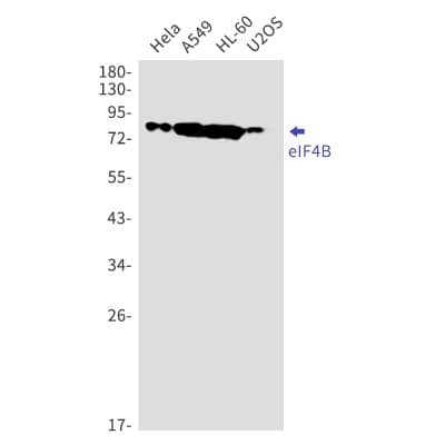 Western Blot: eIF4B Antibody (S07-2H2) [NBP3-19859]