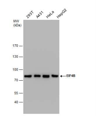 Western Blot: eIF4B Antibody [NBP2-16306]