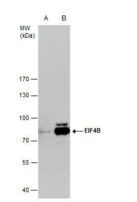 Western Blot: eIF4B Antibody [NBP2-16306]