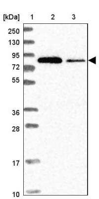 Western Blot: eIF4B Antibody [NBP2-33284]