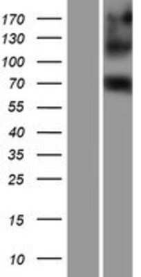 Western Blot: eIF4B Overexpression Lysate [NBP2-08211]