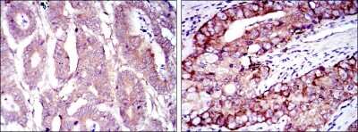 Immunohistochemistry-Paraffin: eIF4E Antibody (5D11) - BSA Free [NBP2-22177]