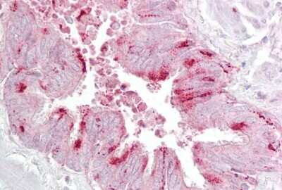 Immunohistochemistry-Paraffin: eIF4E Antibody [NBP1-57195]