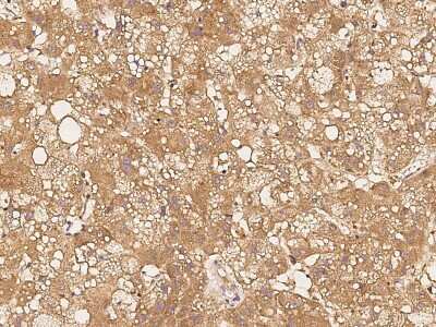 Immunohistochemistry-Paraffin: eIF4E Antibody [NBP2-98867]