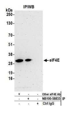 Immunoprecipitation: eIF4E Antibody [NB100-58833]
