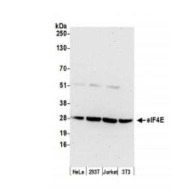 Western Blot: eIF4E Antibody [NB100-58833]