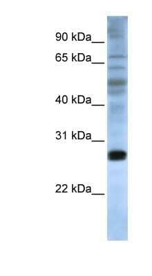Western Blot: eIF4E Antibody [NBP1-57195]