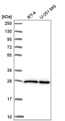 Western Blot: eIF4E Antibody [NBP2-57098]