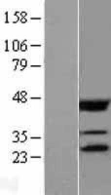 Western Blot: eIF4E Overexpression Lysate [NBL1-10204]