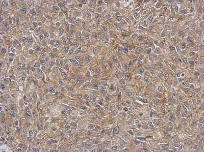Immunohistochemistry-Paraffin: 4EBP1 Antibody [NBP2-16307]