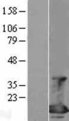 Western Blot: 4EBP1 Overexpression Lysate [NBL1-10206]