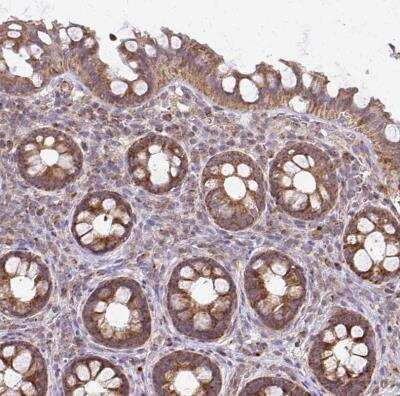 Immunohistochemistry-Paraffin: eIF4EBP2 Antibody [NBP2-37985]