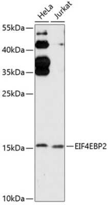 Western Blot: eIF4EBP2 AntibodyAzide and BSA Free [NBP3-05131]