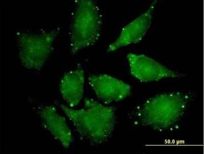 Immunocytochemistry/ Immunofluorescence: eIF4ENIF1 Antibody [H00056478-B01P]