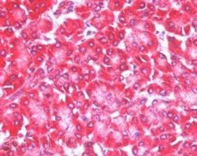 Immunohistochemistry: eIF4ENIF1 Antibody [NB100-1368]