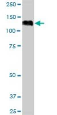 Western Blot: eIF4ENIF1 Antibody [H00056478-B01P]