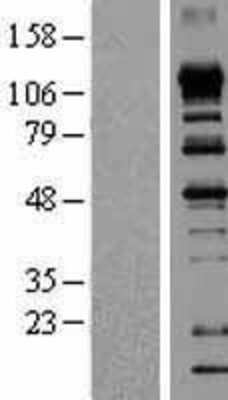 Western Blot: eIF4ENIF1 Overexpression Lysate [NBP2-06705]