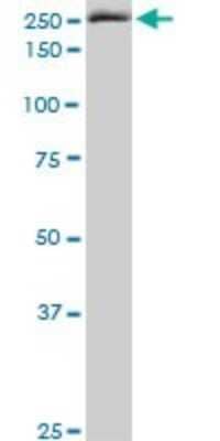 Western Blot: eIF4G1 Antibody (2A9) [H00001981-M10]