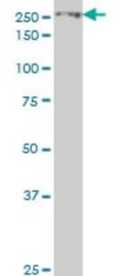 Western Blot: eIF4G1 Antibody (2A9) [H00001981-M10]