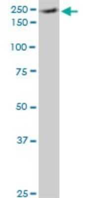 Western Blot: eIF4G1 Antibody (2A9) [H00001981-M10]